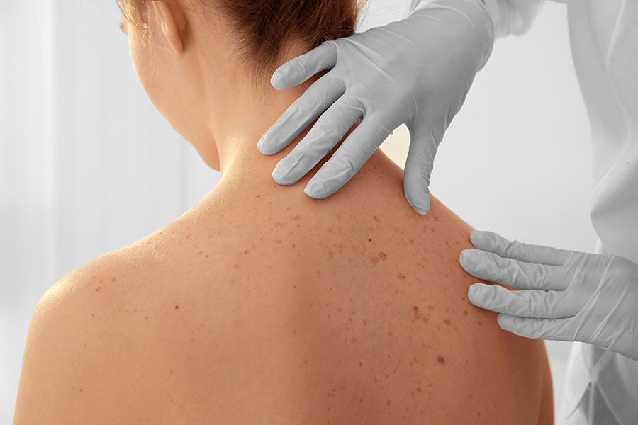 Dermatología